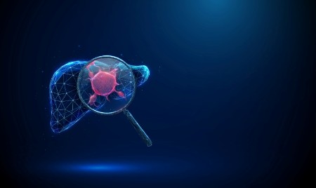 Adenoma de hígado