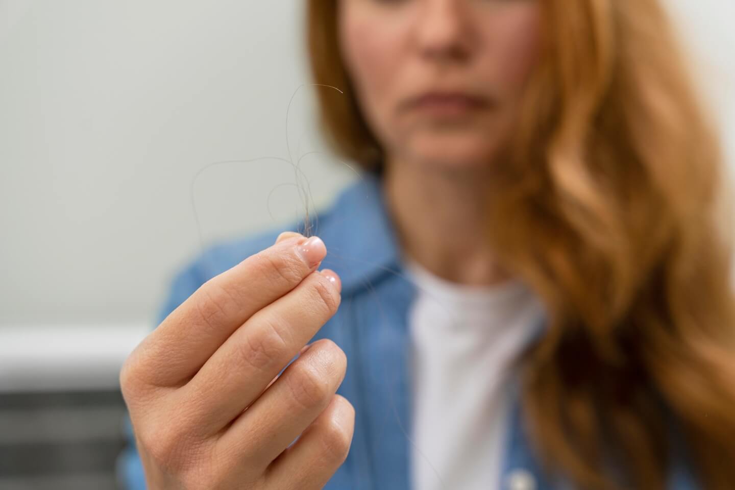 caída exagerada del cabello causada por el estrés