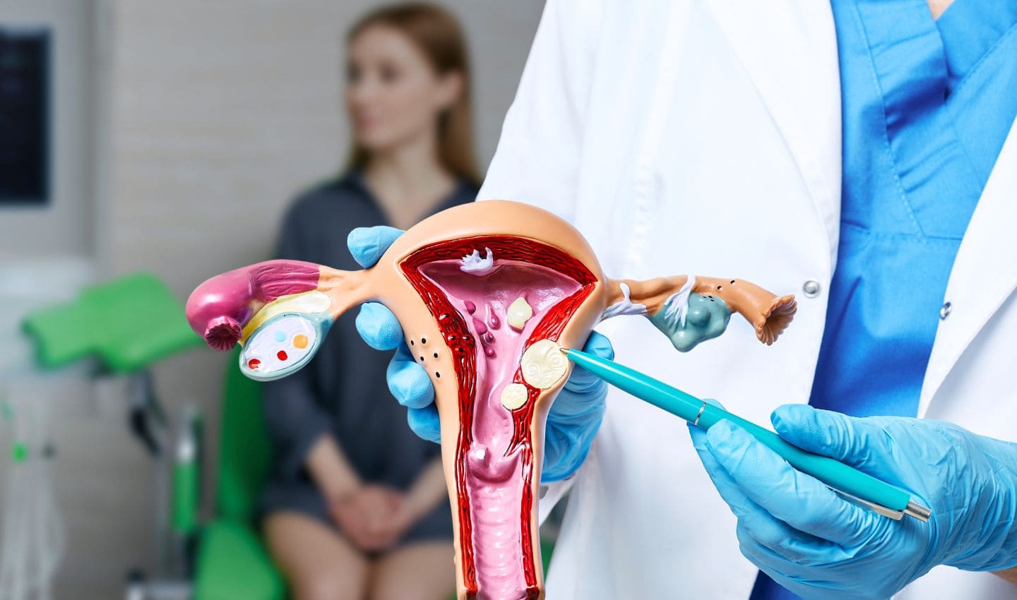 miomas uterinos diagnóstico y tratamiento