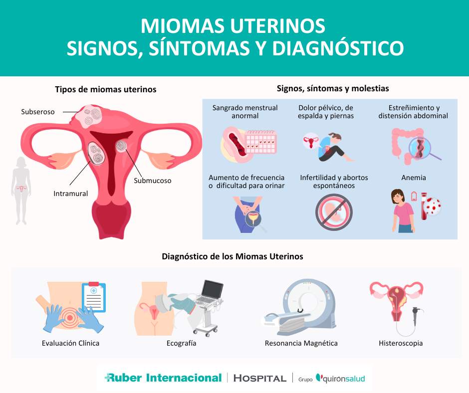 diagnostico tratamiento de mioma uterino