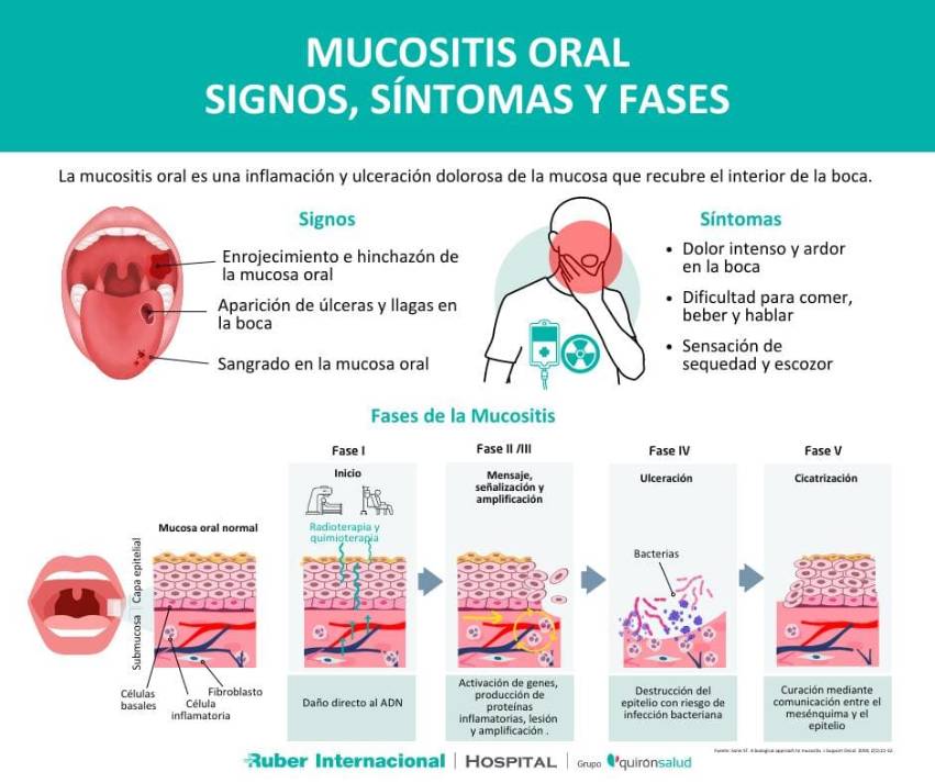 Mucositis que es signos sintomas fases