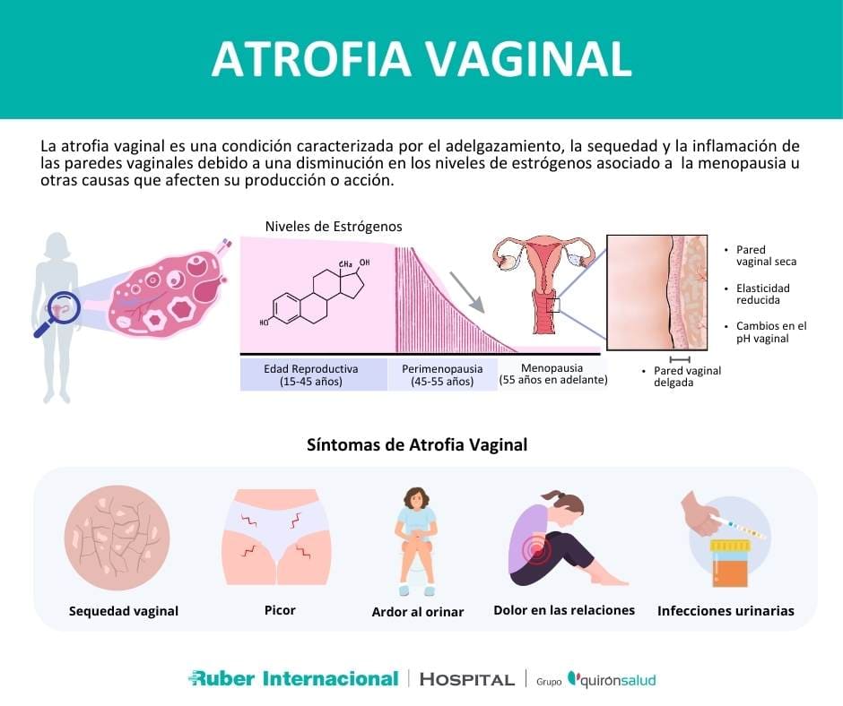 Atrofia sequedad vaginal causas y sintomas