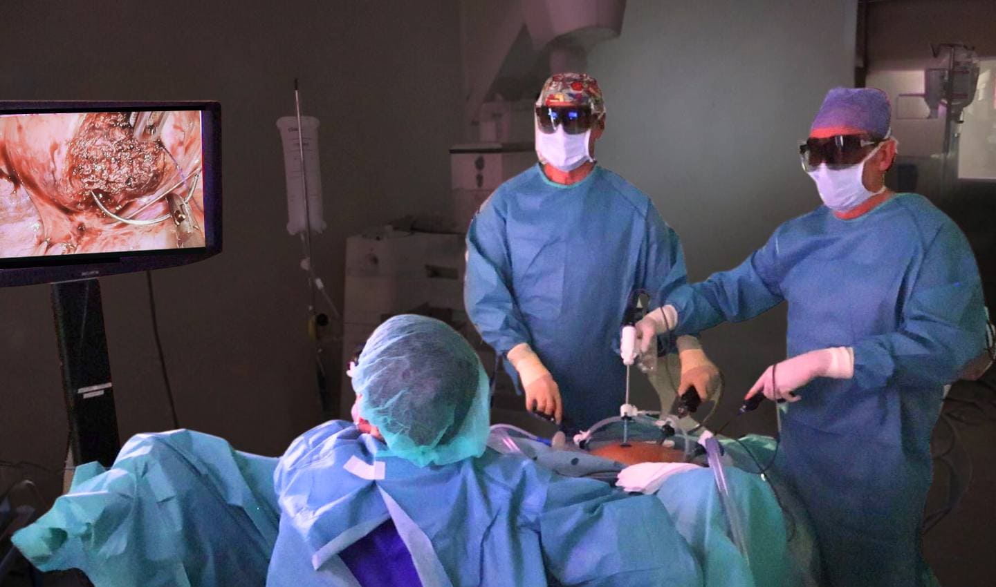 tratamiento miomas uterinos cirugía laparoscopia