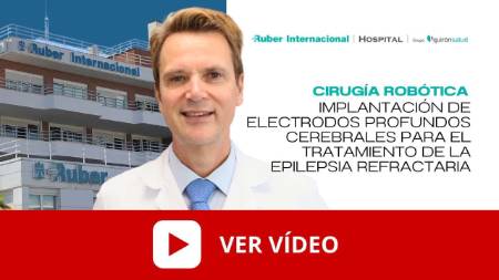 Vídeo Implantación robotica electrodos profundos tratamiento epilepsia refractaria. Este enlace se abrirá en una ventana nueva