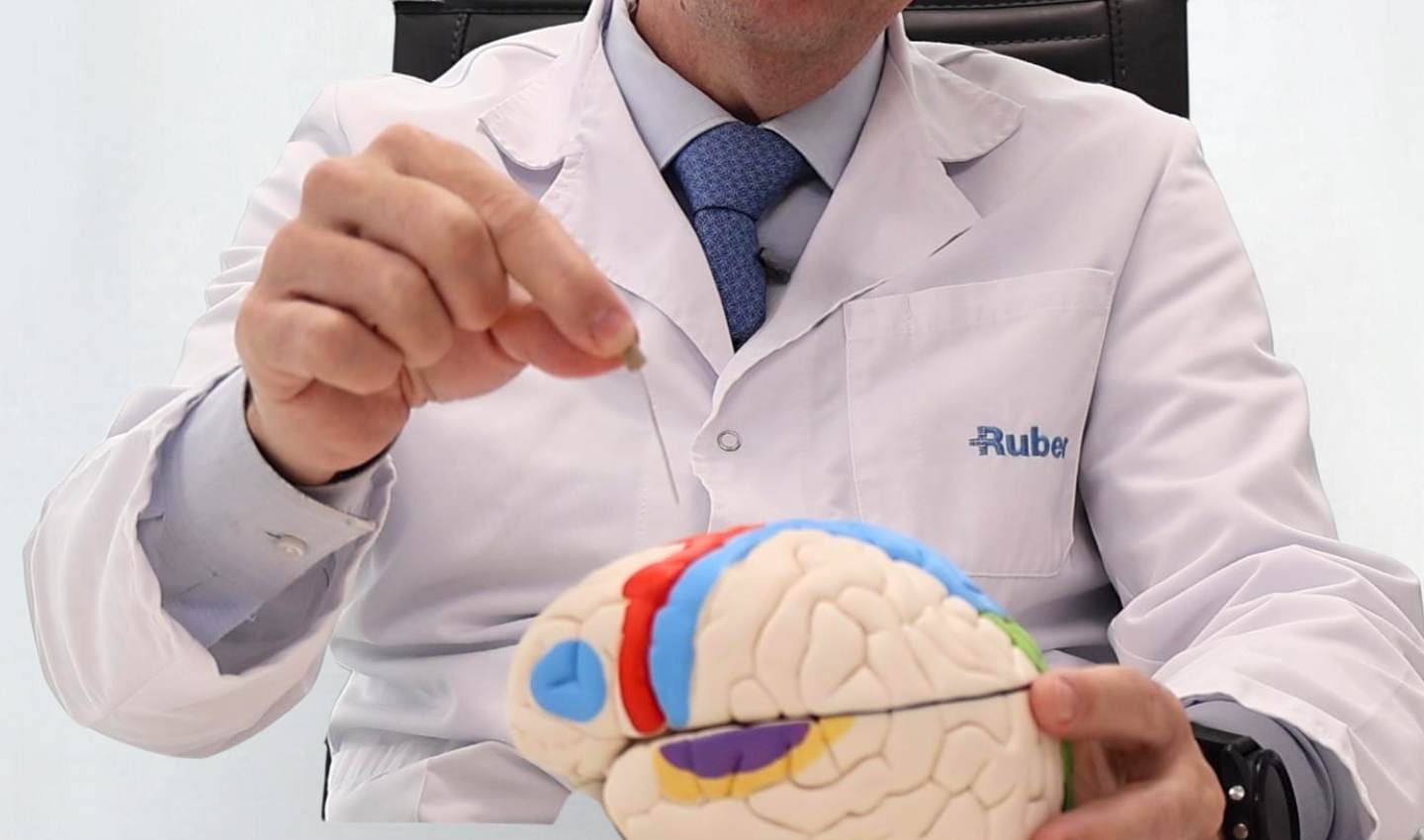 Colocación electrodos cerebrales profundos robotica tratamiento epilepsia refractaria