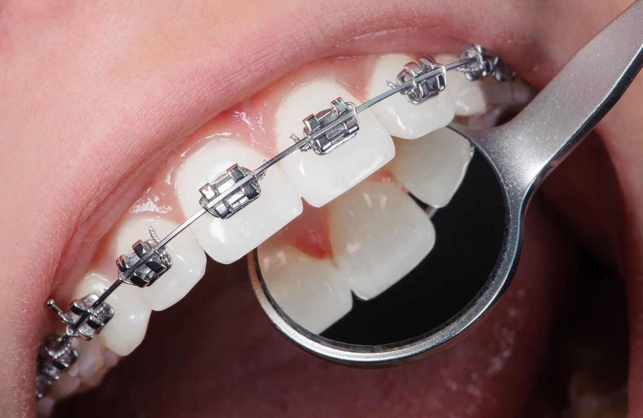 Resolucion de Problemas Clinicos en Ortodoncia y Odontopediatria