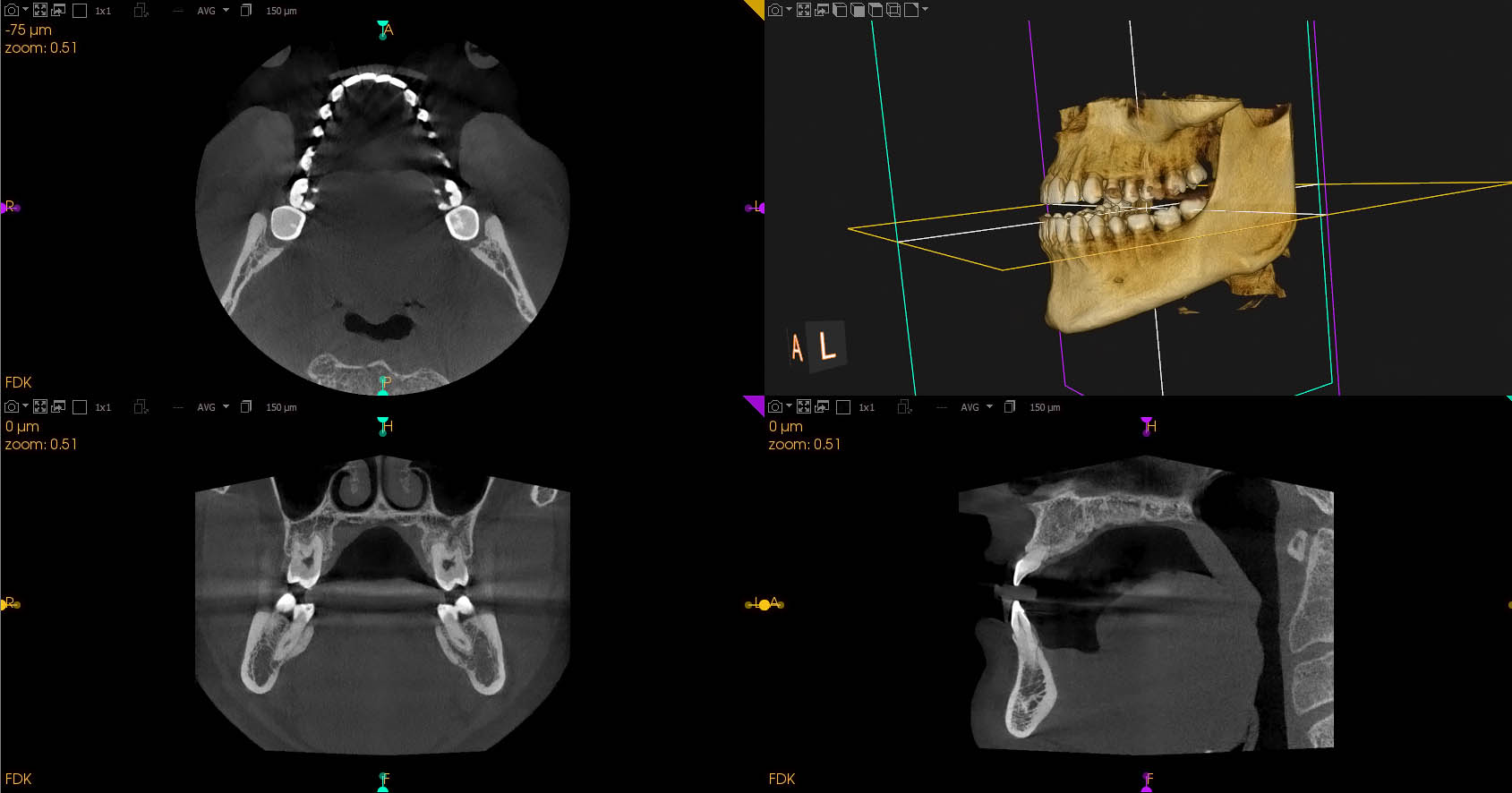orthopantomograph-panoramic dental-x-ray-maxillofacial