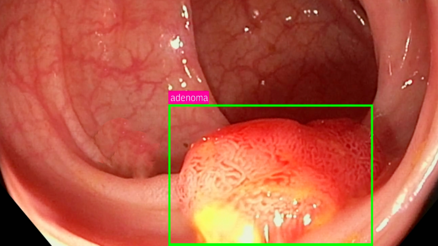 IA Genius Olympia CM Pozuelo