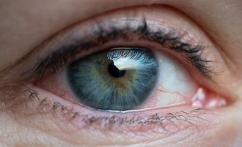 como ve una persona con glaucoma-tenerife